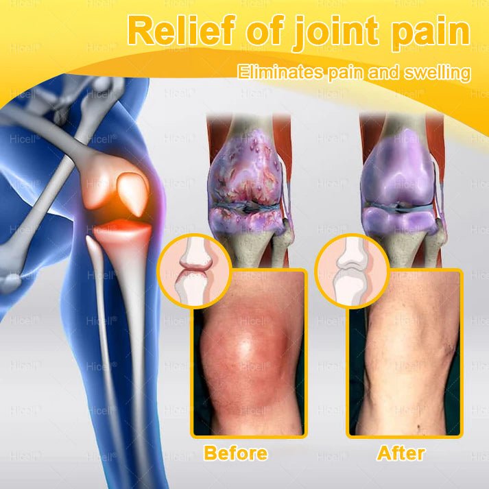 𝙃𝒊𝒄𝒆𝒍𝒍® Bee Venom Pain-Relief Bone Healing Cream 🎄🎄(Specially for older adults)