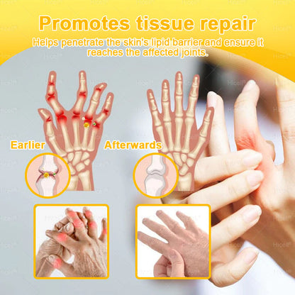 𝙃𝒊𝒄𝒆𝒍𝒍® Bee Venom Pain-Relief Bone Healing Cream 🎄🎄(Specially for older adults)