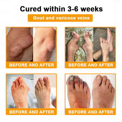 𝙃𝒊𝒄𝒆𝒍𝒍® Bee Venom Pain-Relief Bone Healing Cream 🎄🎄(Specially for older adults)