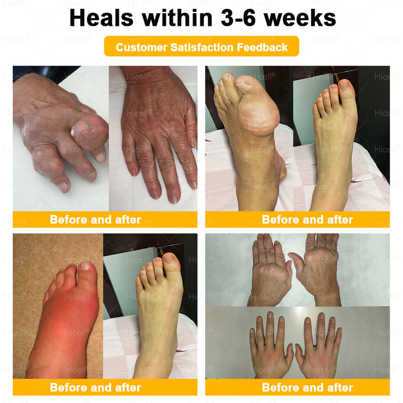 𝙃𝒊𝒄𝒆𝒍𝒍® Bee Venom Pain-Relief Bone Healing Cream 🎄🎄(Specially for older adults)