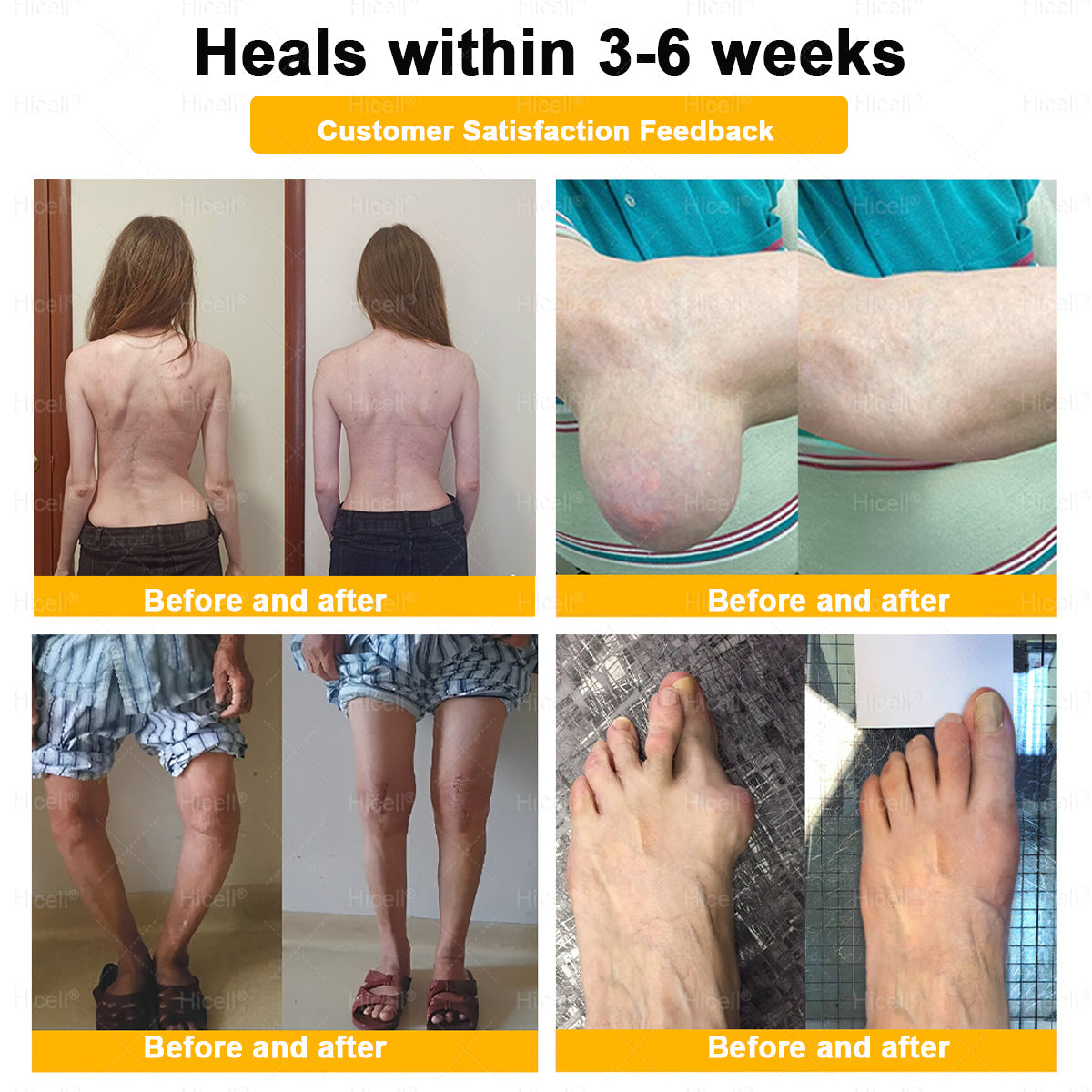 𝙃𝒊𝒄𝒆𝒍𝒍® Bee Venom Pain-Relief Bone Healing Cream 🎄🎄(Specially for older adults)