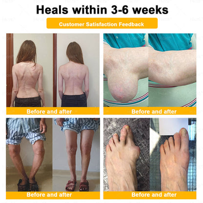 𝙃𝒊𝒄𝒆𝒍𝒍® Bee Venom Pain-Relief Bone Healing Cream 🎄🎄(Specially for older adults)