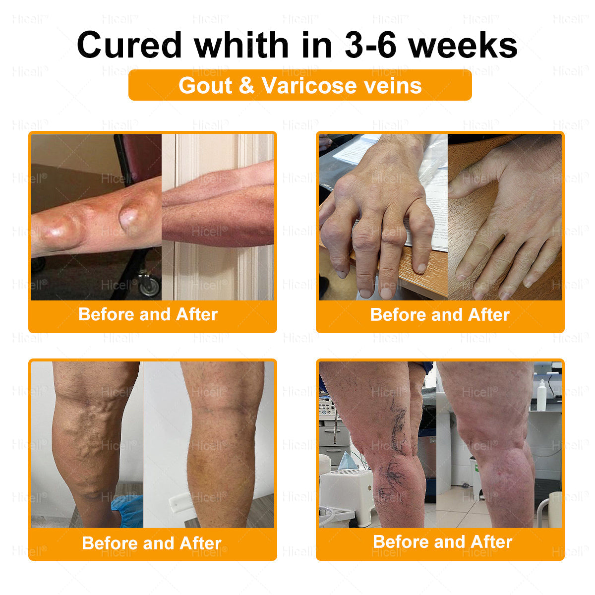 𝙃𝒊𝒄𝒆𝒍𝒍® Bee Venom Pain-Relief Bone Healing Cream 🎄🎄(Specially for older adults)